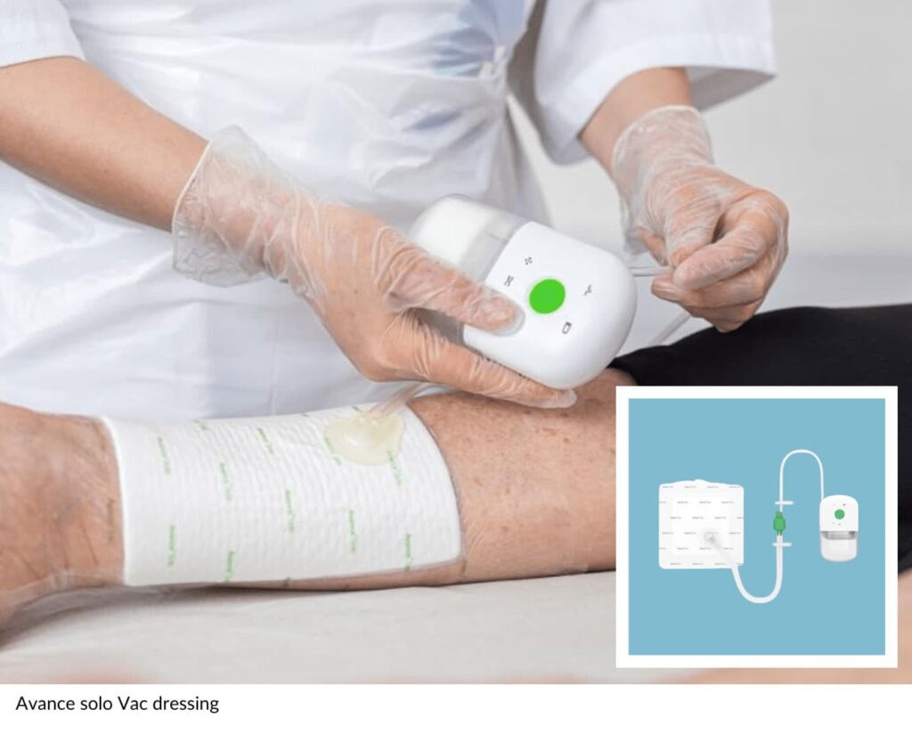 Chronic Wounds - The Vascular & Endovascular Clinic
