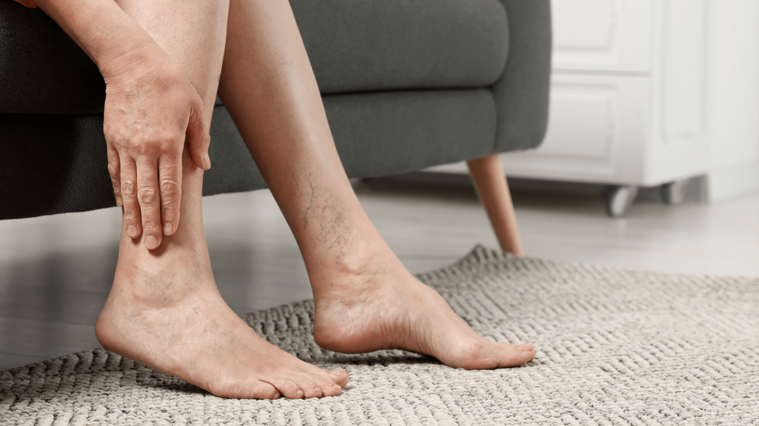 Managing Chronic Venous Insufficiency: Symptoms At Every Stage