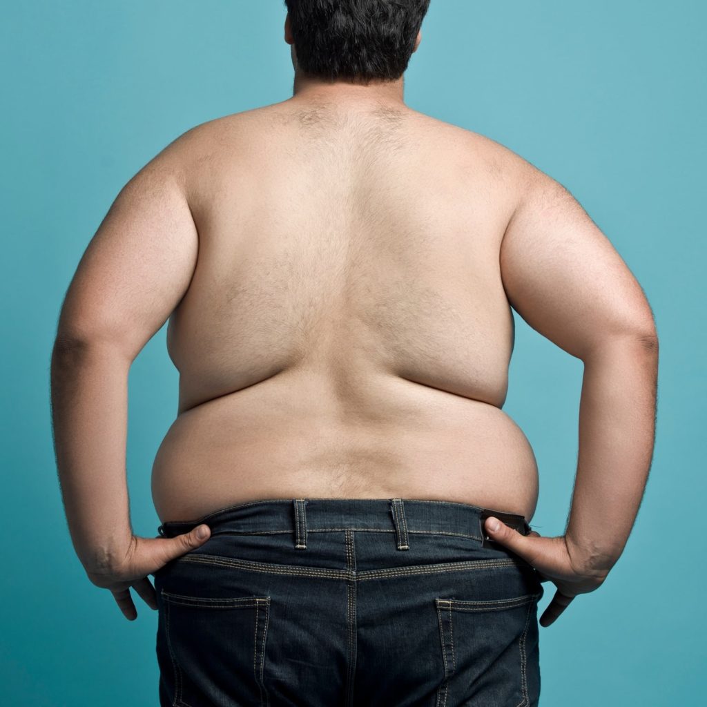 Obesity