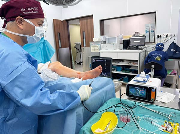First-Use-Curaway-radiofrequency-catheter